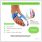 hallux valgus night splint explanation 1
